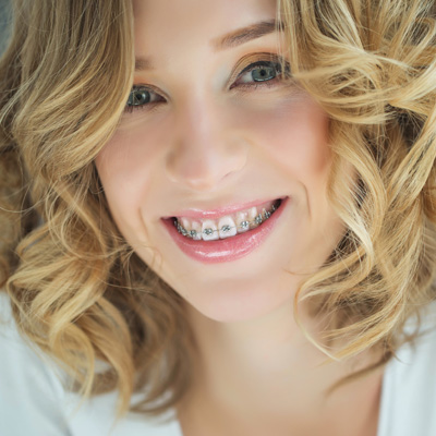 The image is a close-up portrait of a woman with braces, wearing makeup and smiling.