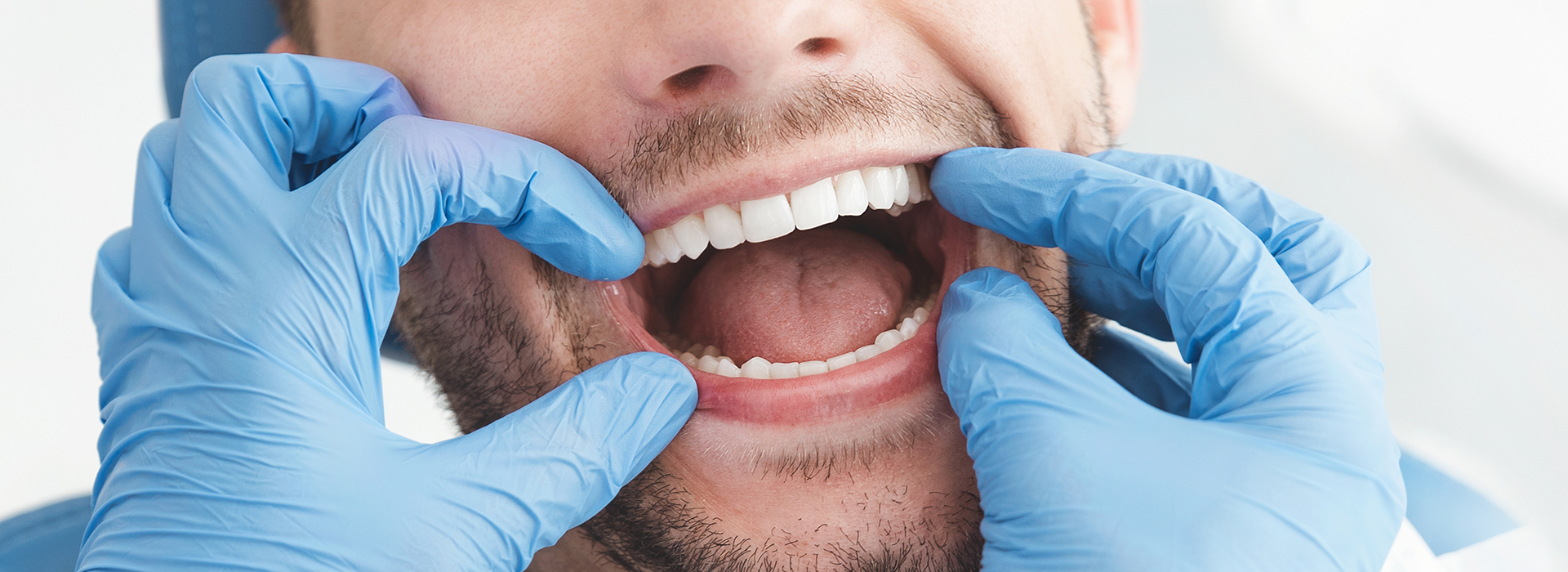 A man wearing blue gloves is holding his mouth open, displaying a row of teeth while being photographed.