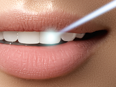 The image shows a close-up of a person s lips with a focus on the teeth, set against a blurred background. There is a blue light emanating from the mouth area, suggesting a technology or product feature related to oral health or beauty.